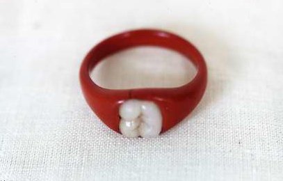 “Tooth” Engagement Ring (1991.035.024)  